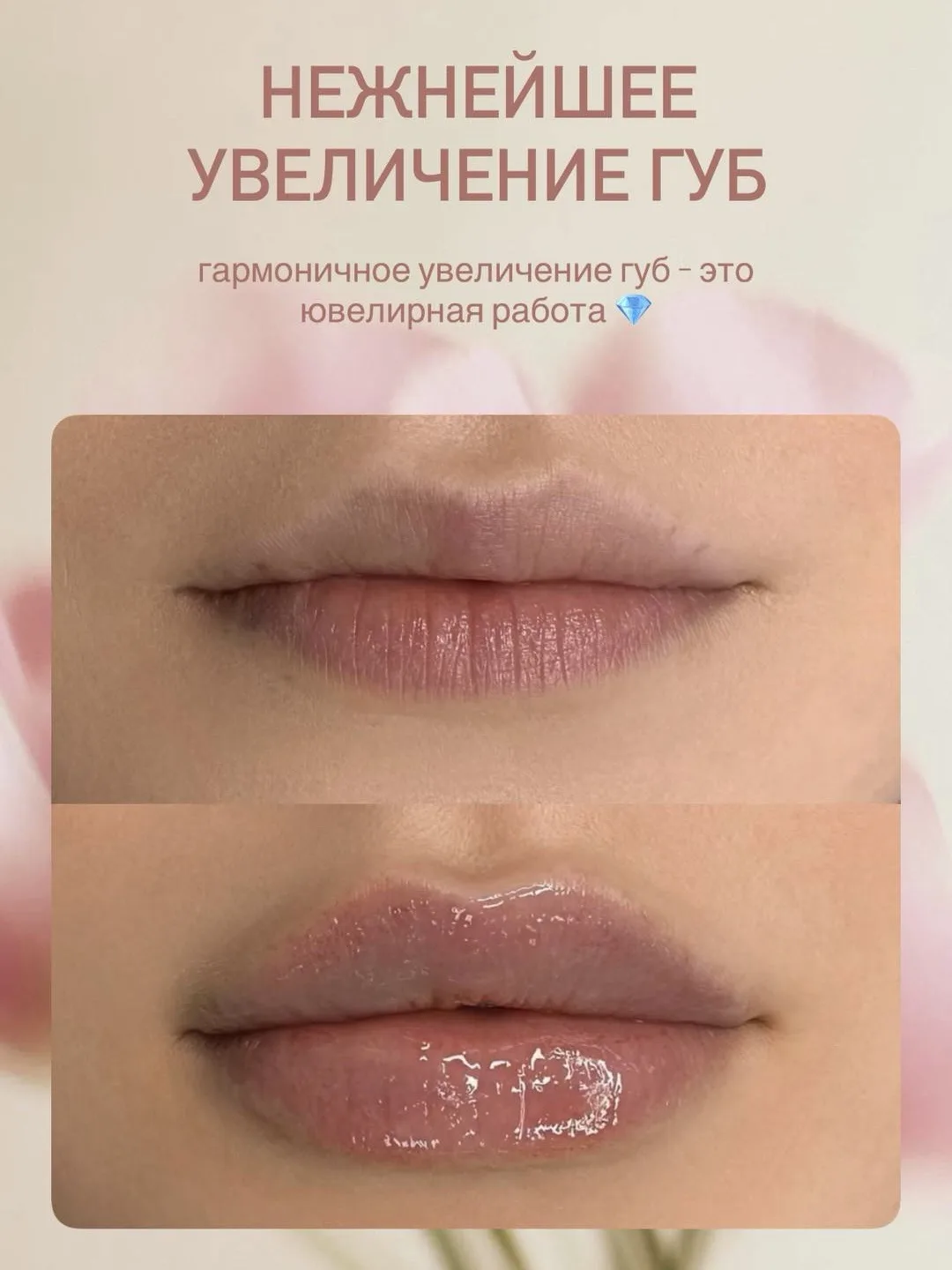 Чувственные губы за 1 час 😍