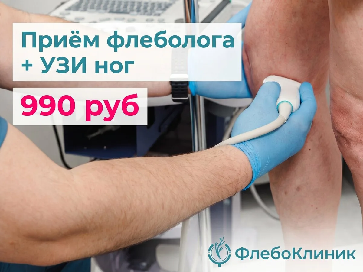 Только в Сентябре! Приём флеболога + УЗИ ног 990 руб