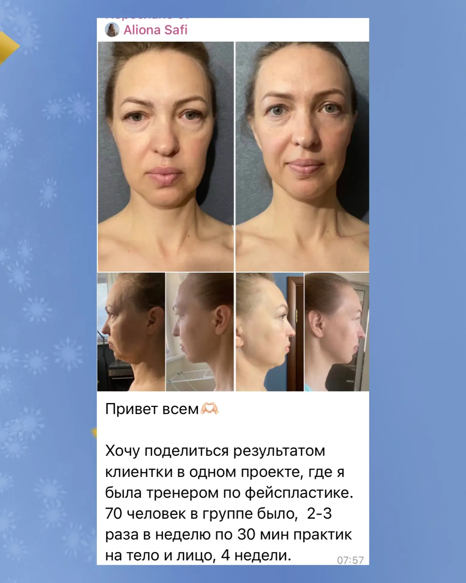 ✨ Что, если настоящая роскошь — это не брендовая сумка и не молодость в паспорте?  А ясная голова по