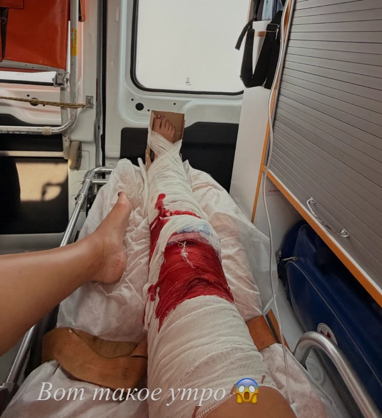 Ольга Бузова перенесла экстренную операцию на ноге после падения в ванной

Певица и телеведущая Ольг