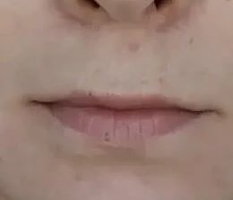 Кп губ до/после
