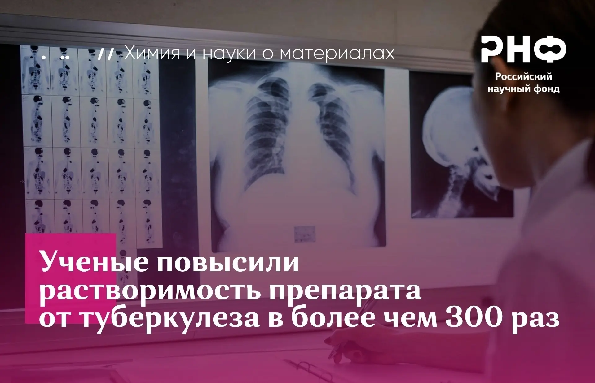 🧪Ивановские ученые увеличили растворимость препарата от туберкулеза в 300 раз    Научная группа Инст