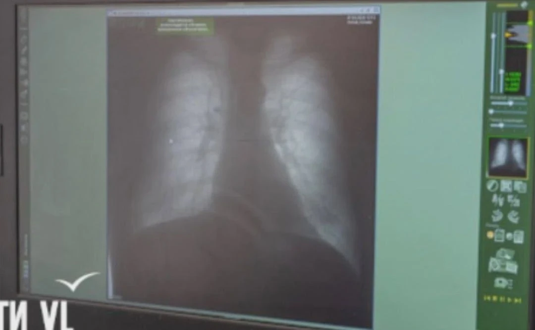 🚭 Вейп едва не погубил студента во Владивостоке