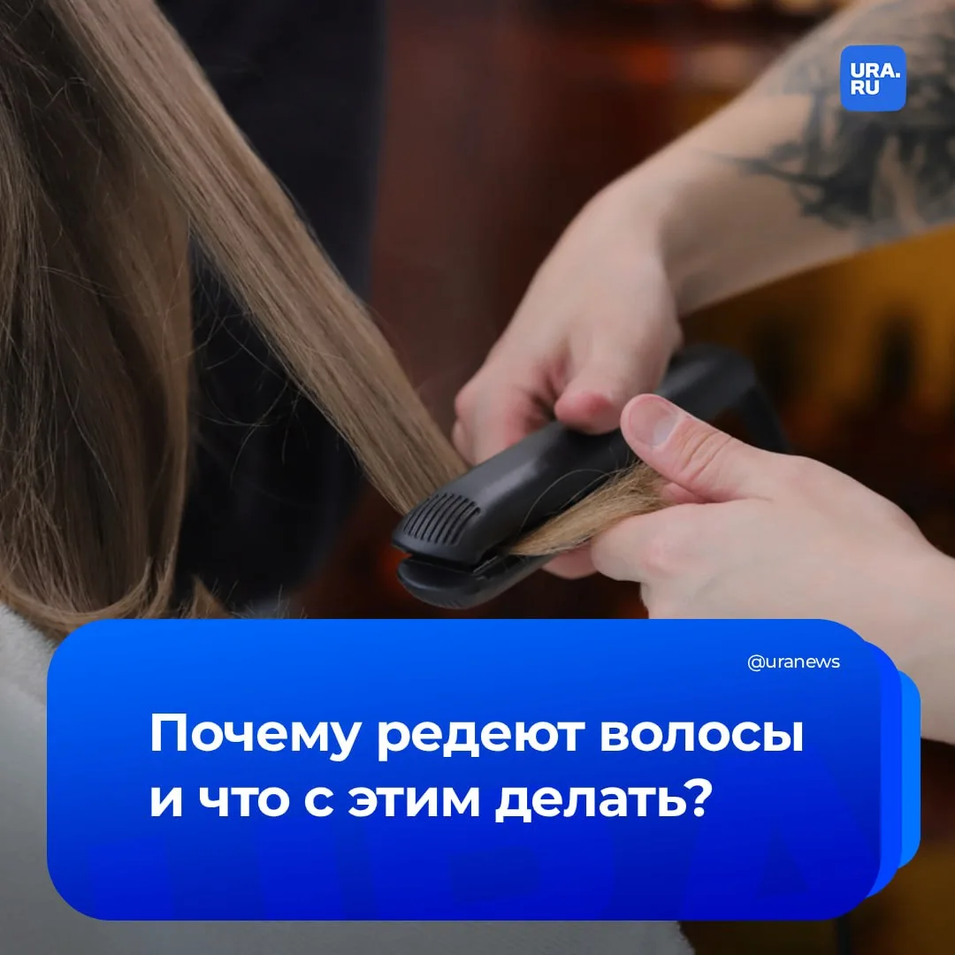 Волосы редеют, а причины непонятны?