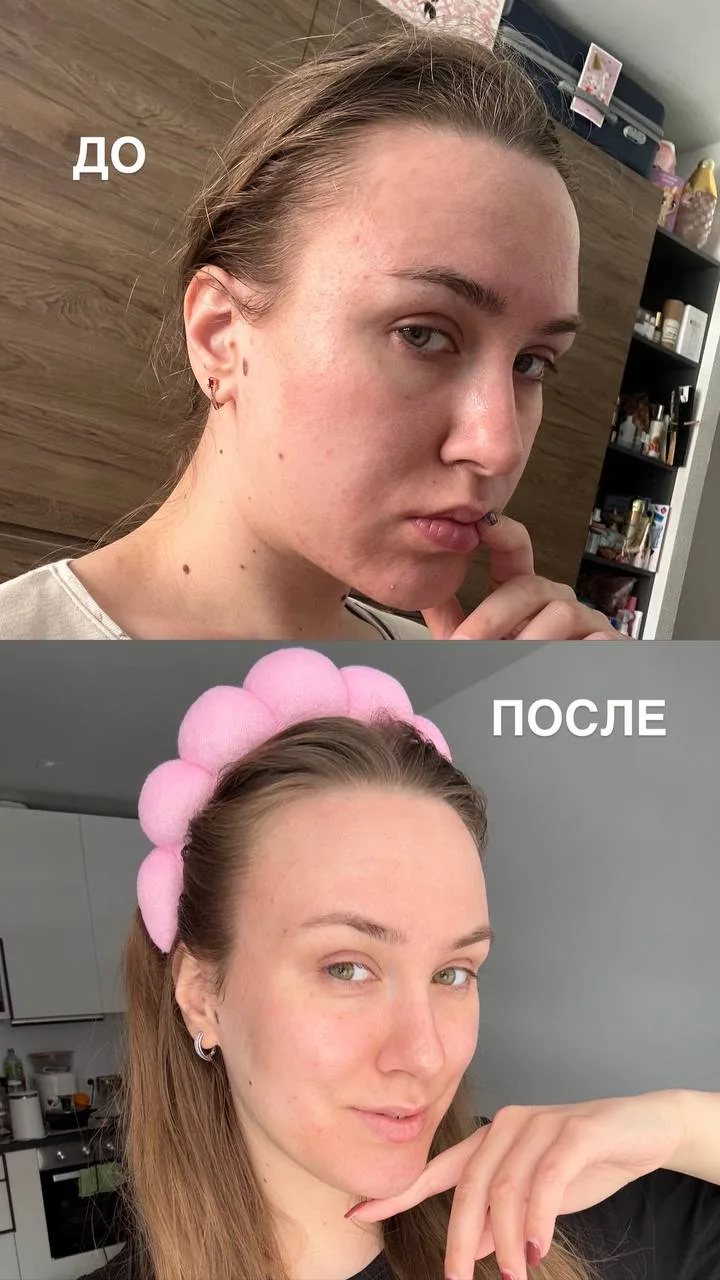 Никогда не куплю увлажняющий крем без витамина С 🧴 И вам не советую!   Если у вас, как и у меня, кат