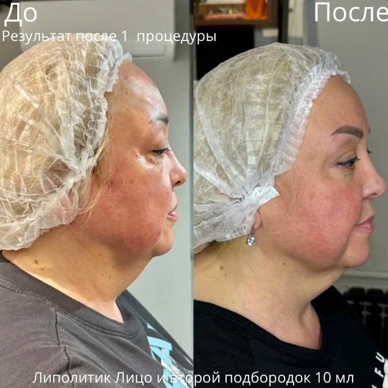 ✨ Косметологические процедуры по специальным ценам ✨