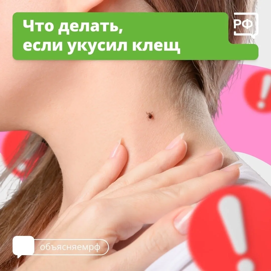 Вместе с клещом можно подцепить опасные болезни. Например, боррелиоз — он затрагивает к...