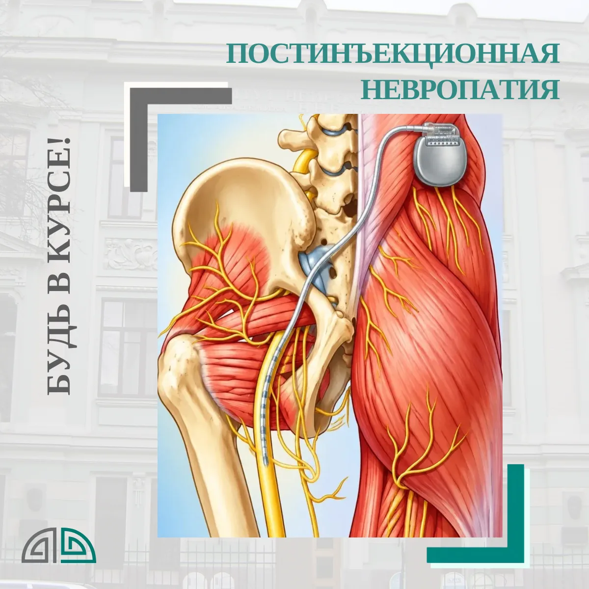 Постинъекционная невропатия: как обычный укол в «неправильных» руках может привести к и...