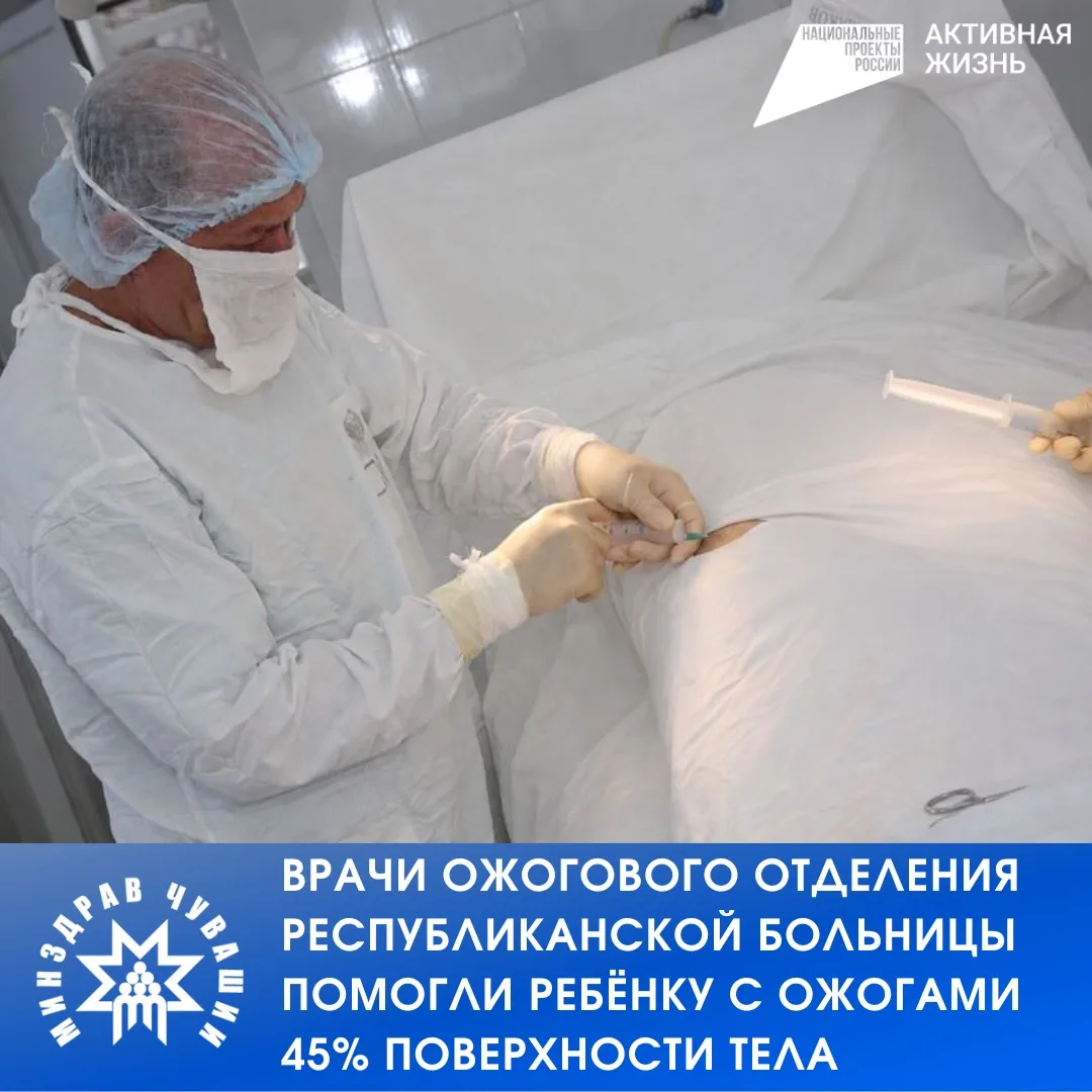 Врачи ожогового отделения Республиканской клинической больницы продолжают оказывать спе...