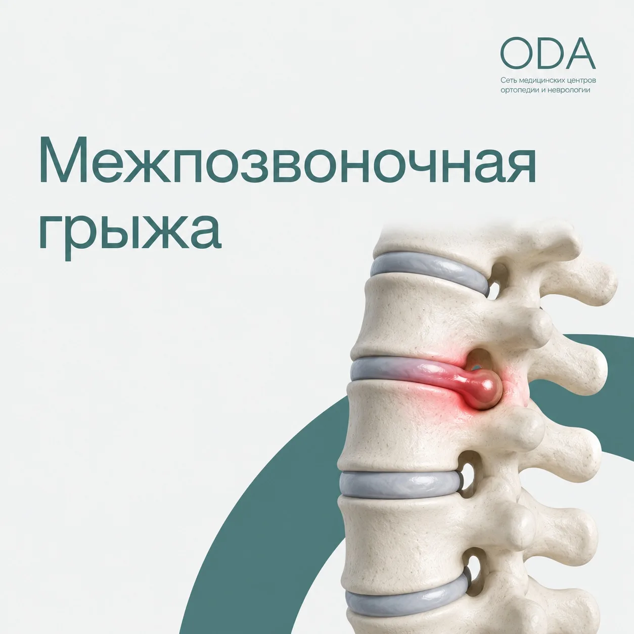 🆘 Боль в спине отдает в ногу? Онемение, скованность, прострелы? Это может быть межпозв...