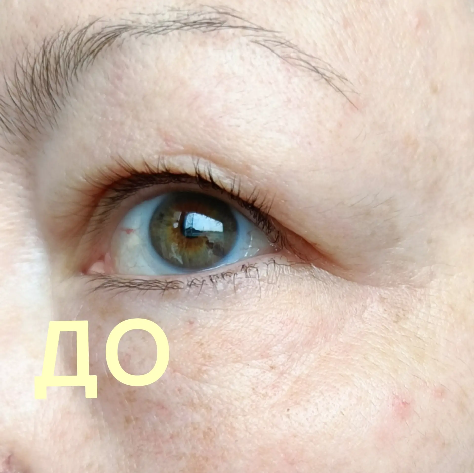 Мои ДО и ПОСЛЕ