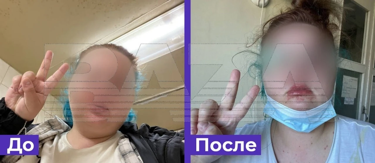 Жительница Петербурга покрылась сыпью и ослепла после приёма препарата, назначенного ей...