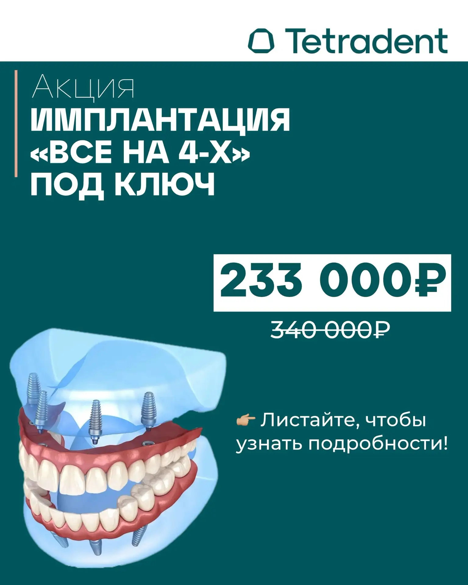 🦷 Акция «Всё на 4-х под ключ»: полный комплекс имплантации с протезированием

Мечтаете о красивой у
