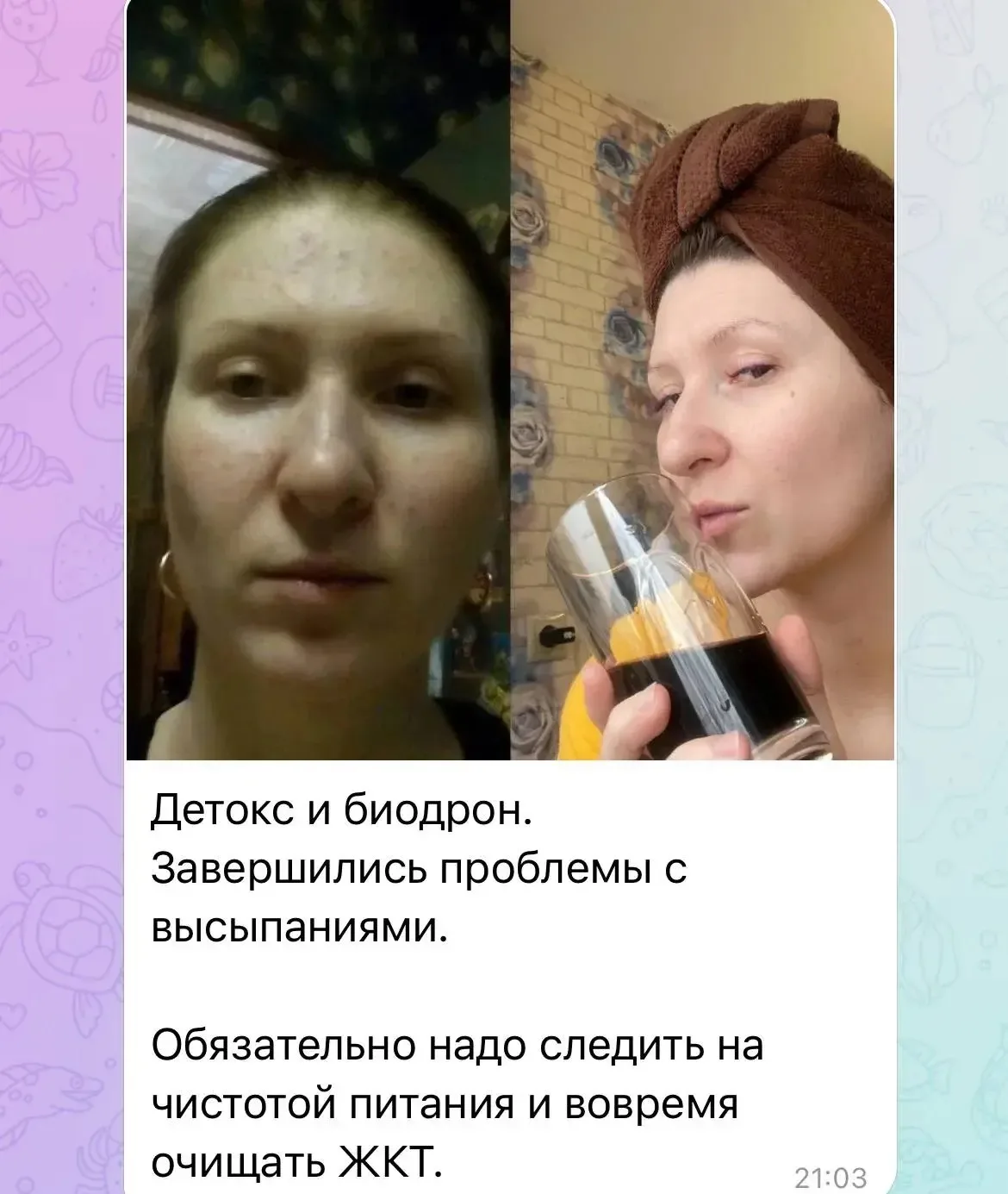 Можно убрать высыпания с помощью грамотного очищения изнутри, которое мы даем на нашем ...