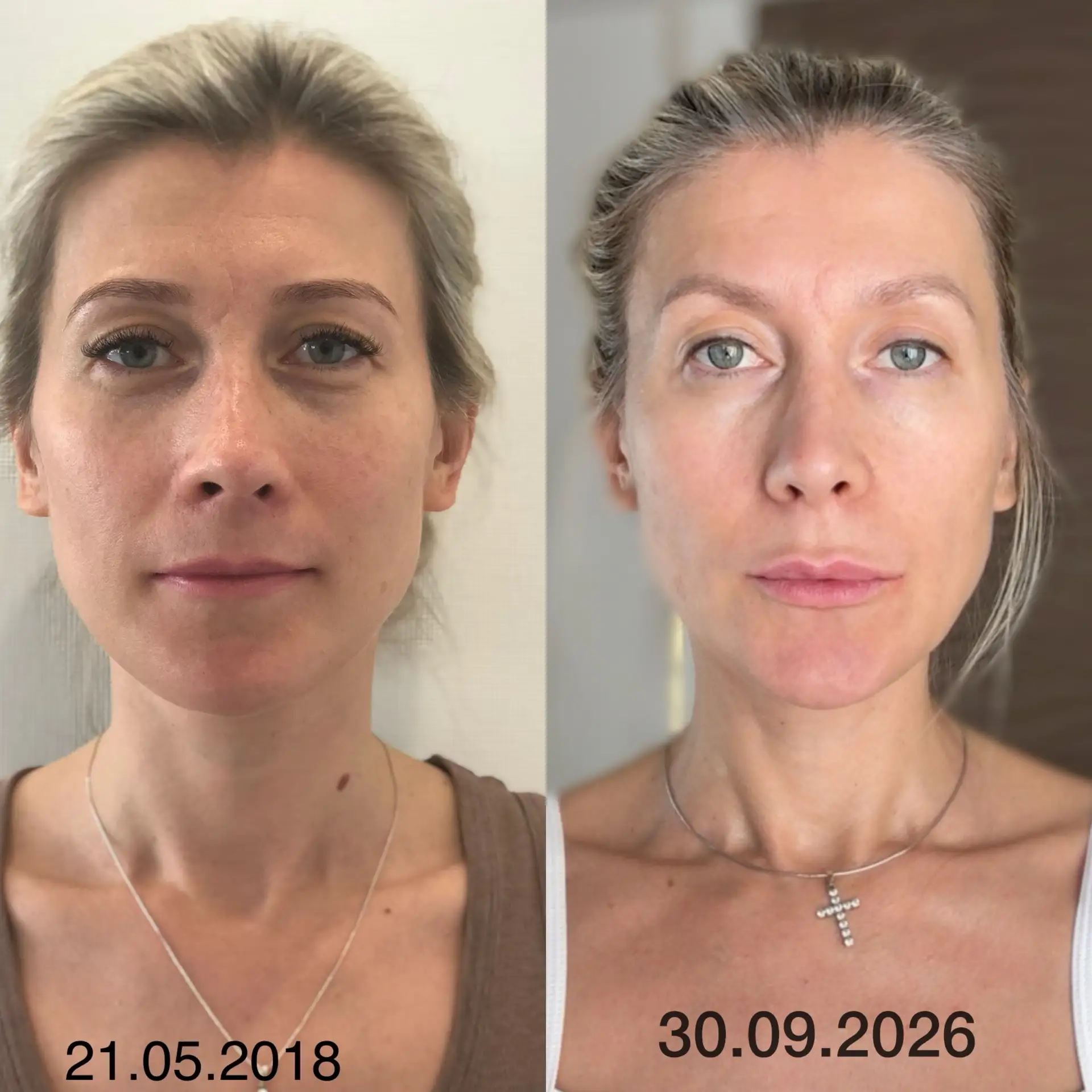 Я даже решила коллаж обновить и сделала свежее фото.