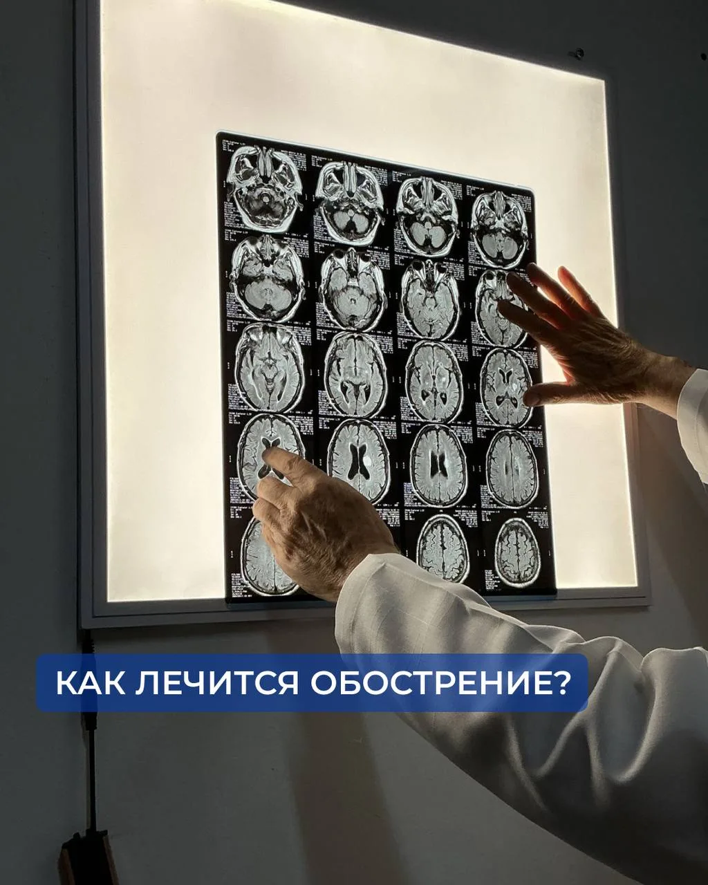 Как лечится обострение?