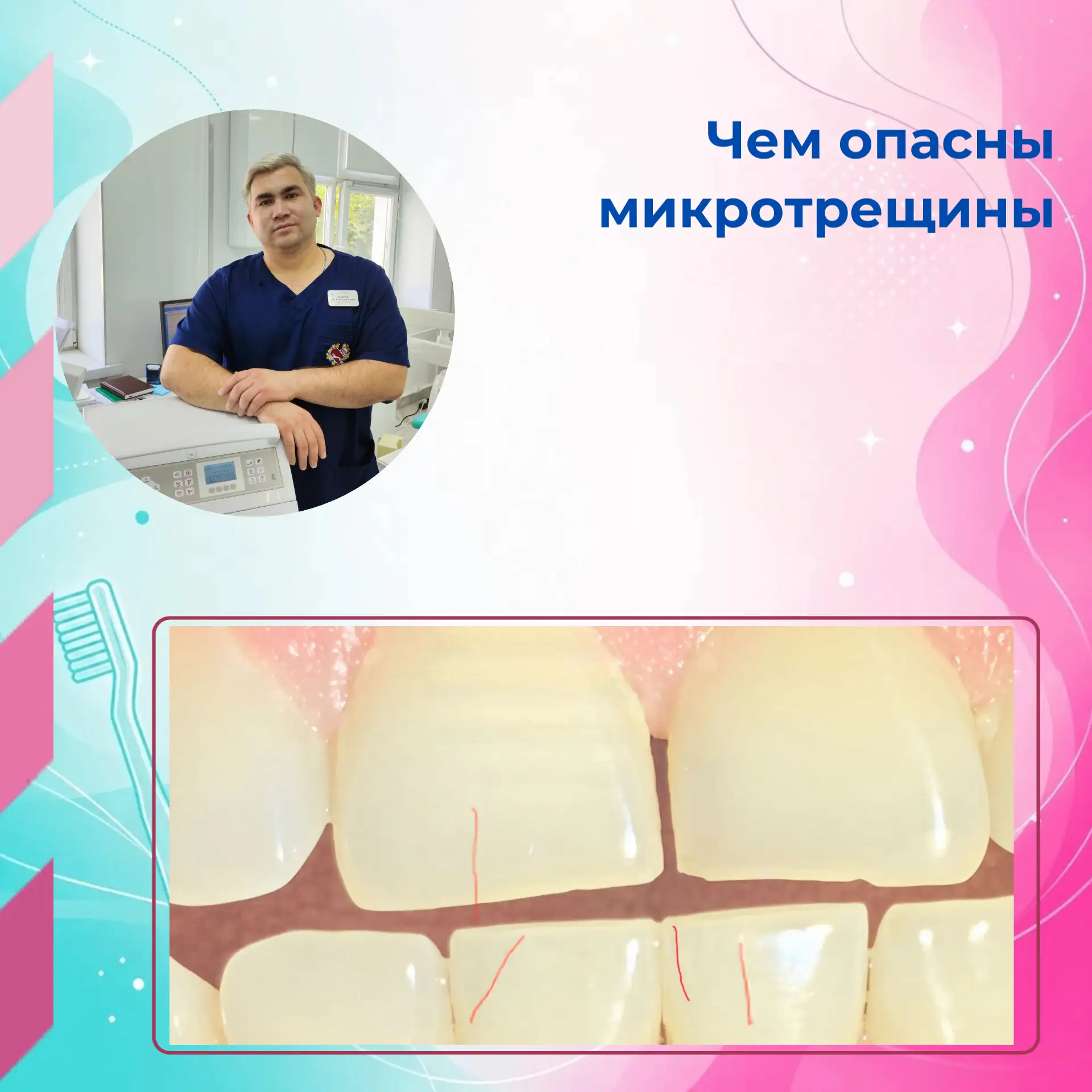 Вчера мы опубликовали фотографию и предложили  угадать диагноз. 

Да, на фотографии -  микротрещины 