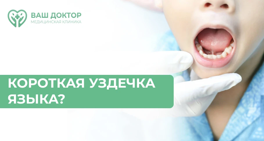 Стоит вопрос о подрезании уздечки языка?