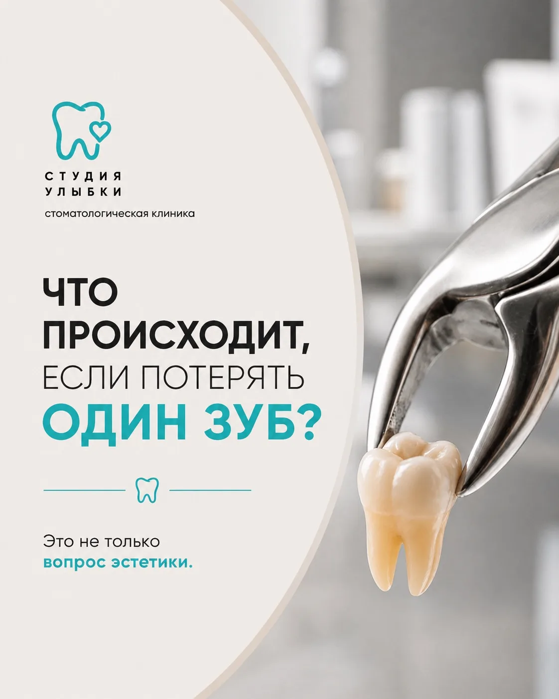 Потеря одного зуба — это не только вопрос эстетики.