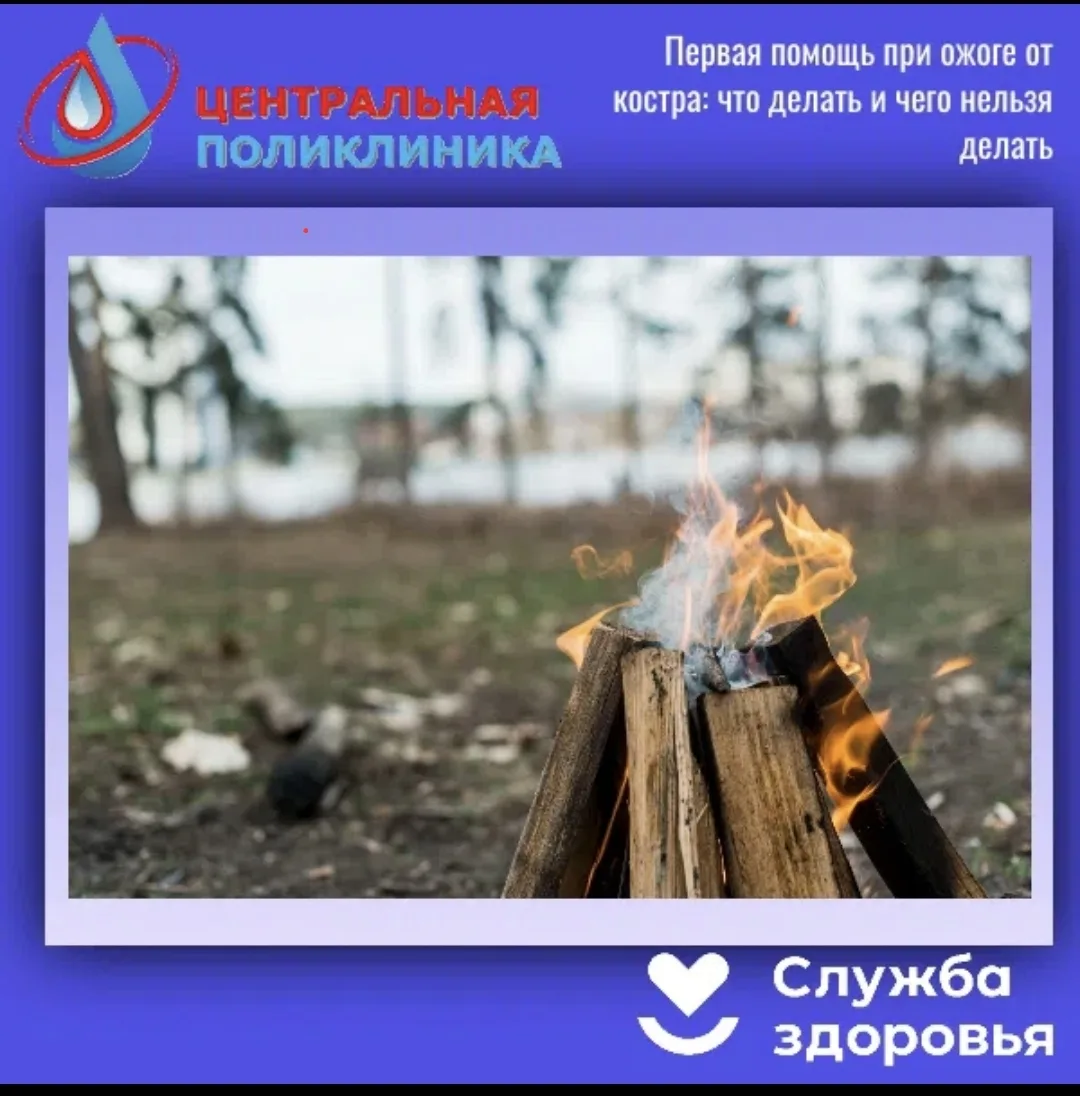 🔥 Первая помощь при ожоге от костра: что делать и чего нельзя делать