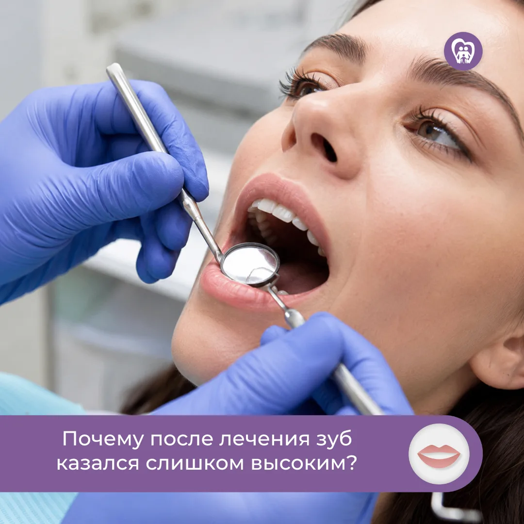 🦷 Почему после лечения зуб казался слишком высоким?