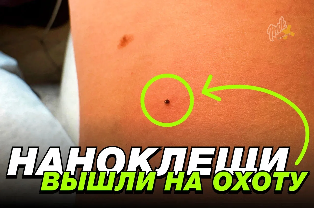 🕷 Ленобласть и Петербург накрыла волна «наноклещей»