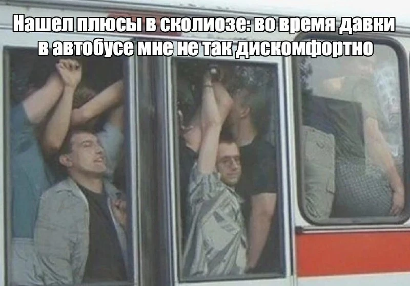 30% детей и подростков в возрасте до 16 лет имеют сколиоз.
80% взрослых людей имеют отчетливый перек