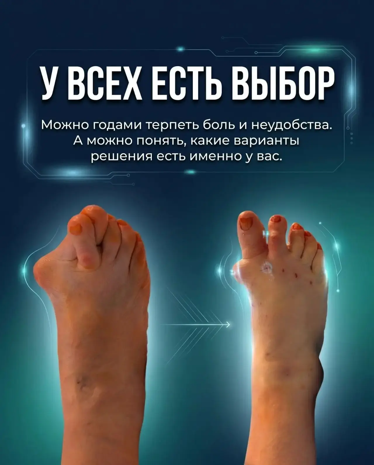 💯Пока боль терпимая — кажется, что ещё не время