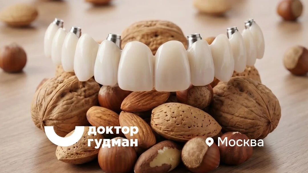 Имплантация зубов в Москве: на 4-х или 6-ти имплантах?