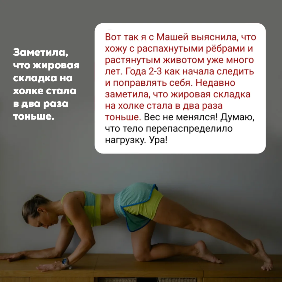 🍌 Гиперэкстензия коленного сустава или в простонародье «банановые колени».   Положение, когда колено
