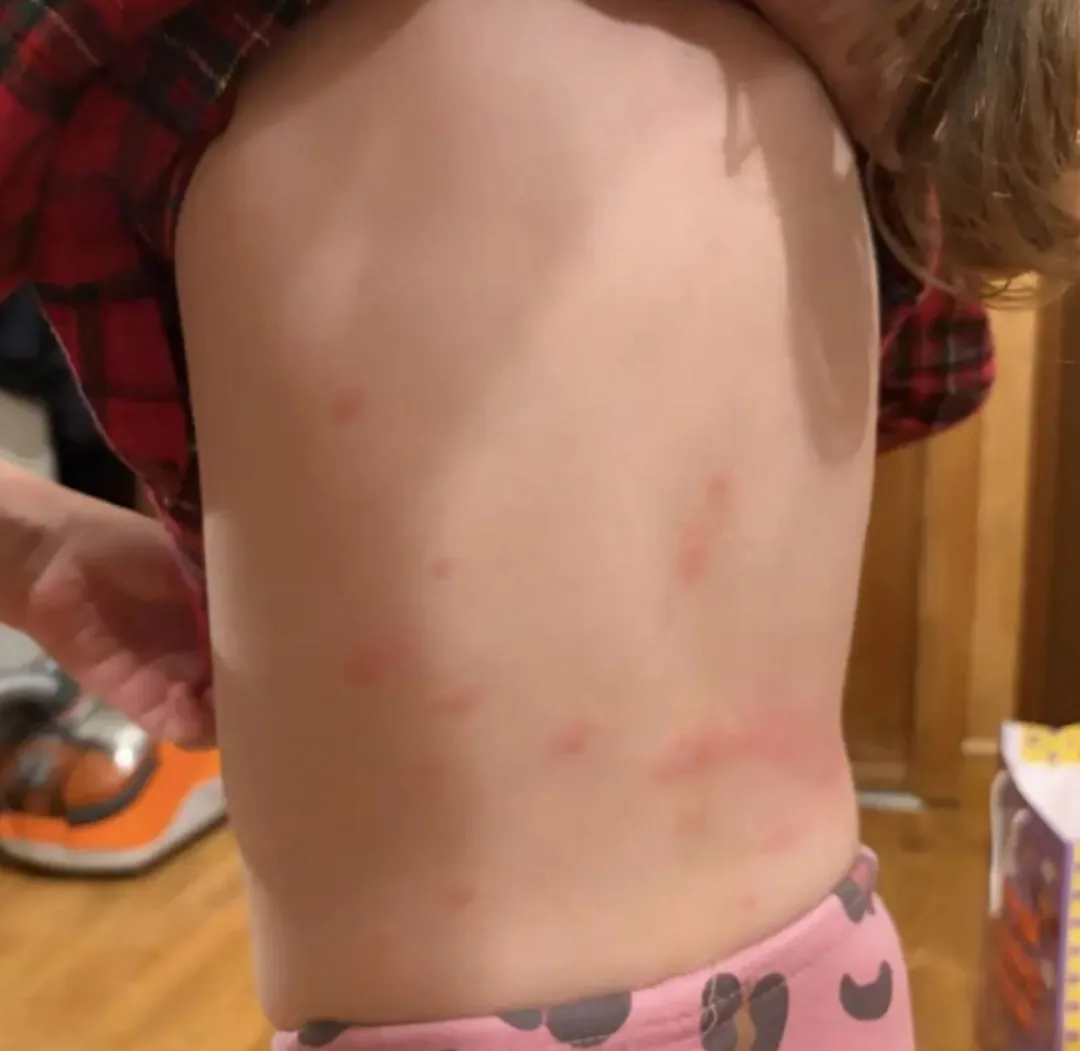 !!! SOS!!! В детском саду кишат блохи по адресу г. Раменское, пос. с-за "Раменское" ул....