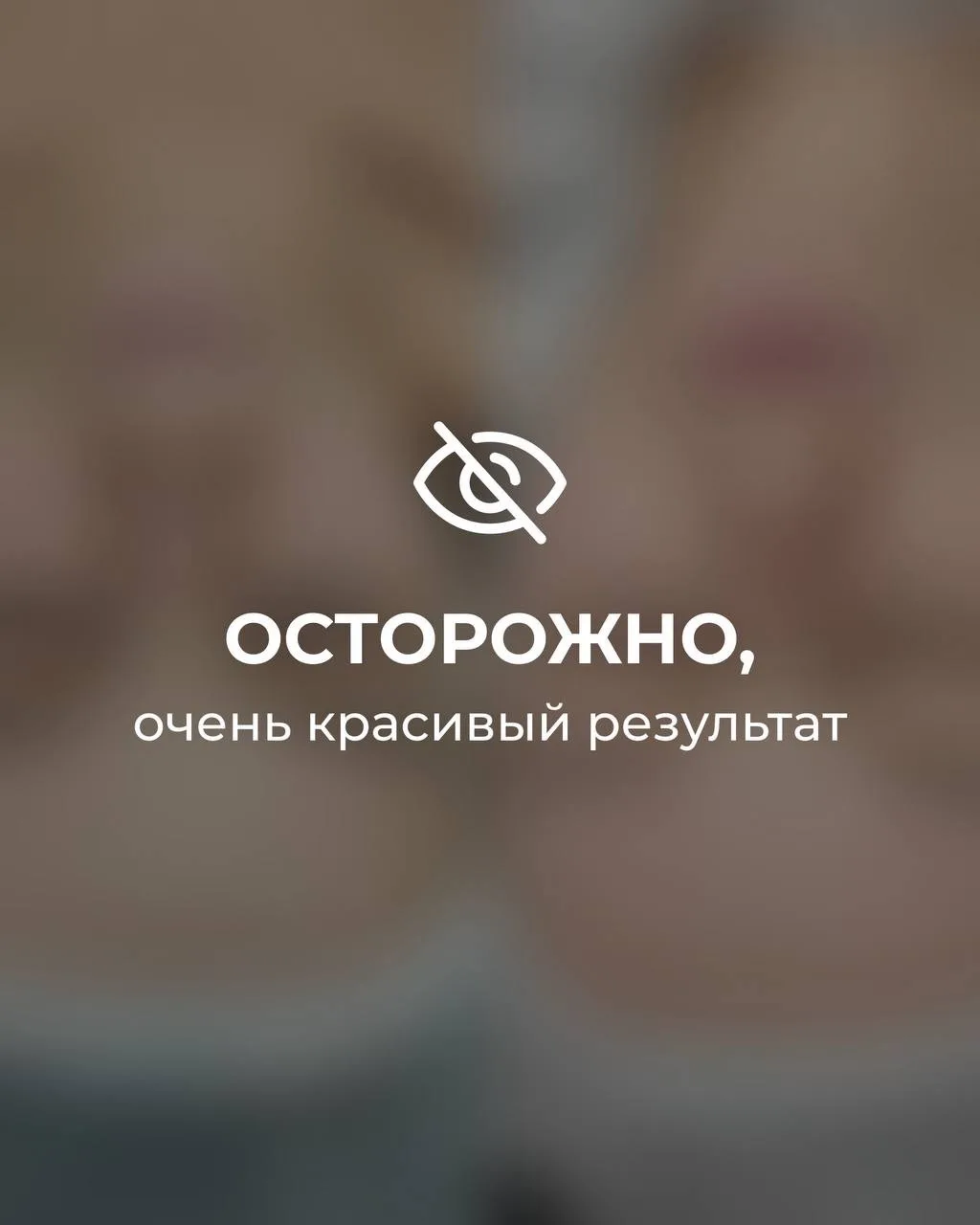 Комплексное омоложение кожи и профилактика возрастных изменений 🤍

Работа врача-косметолога Мышковс