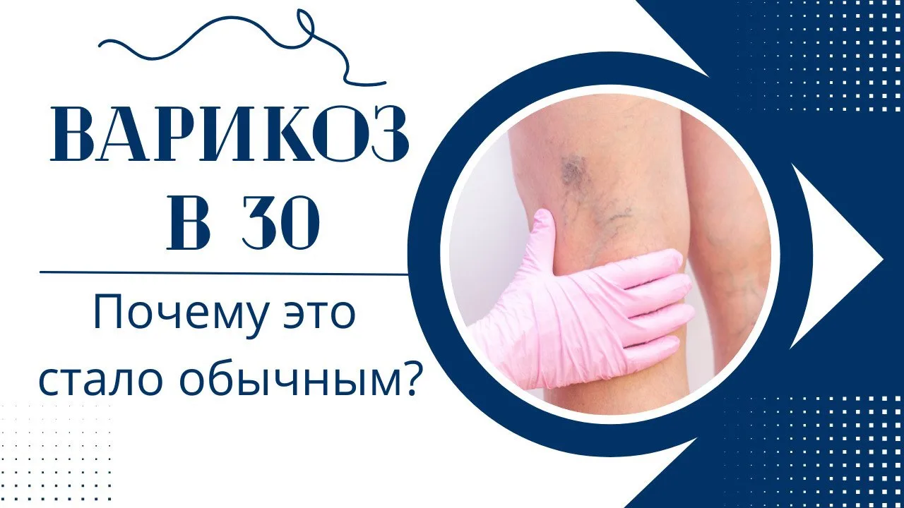 Почему варикоз в 30 лет стал нормой?

Ещё 15–20 лет назад варикоз ассоциировался с пожилым возрастом