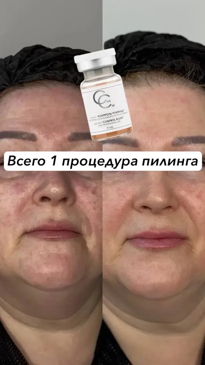 Делимся результатом работы продукта бренда CimiCell, который не так давно появился в по...