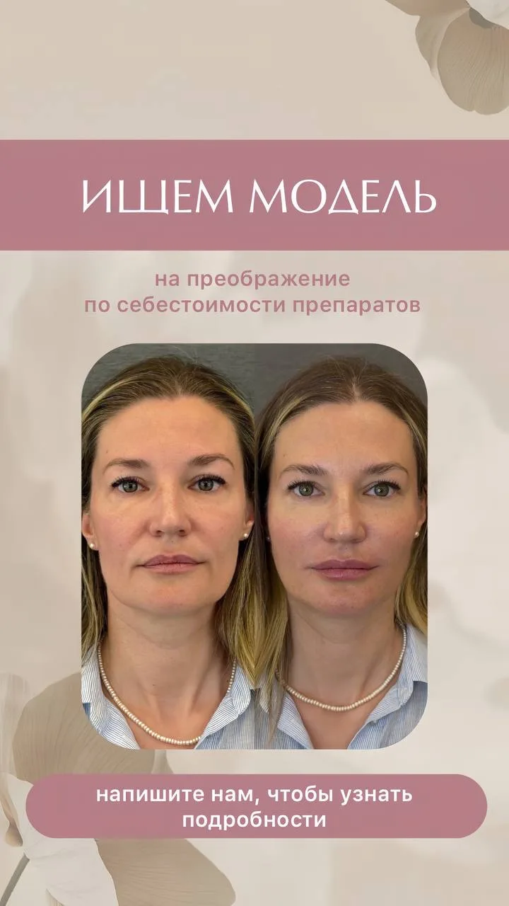 🔥ИЩЕМ МОДЕЛЬ 🔥