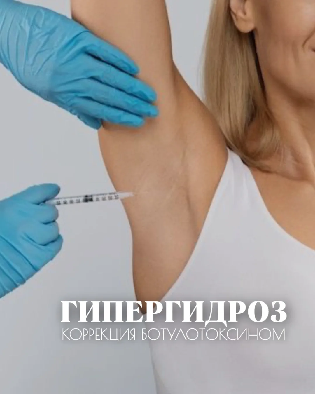 Гипергидроз (повышенное потоотделение) - это не просто особенность организма. Это неудо...