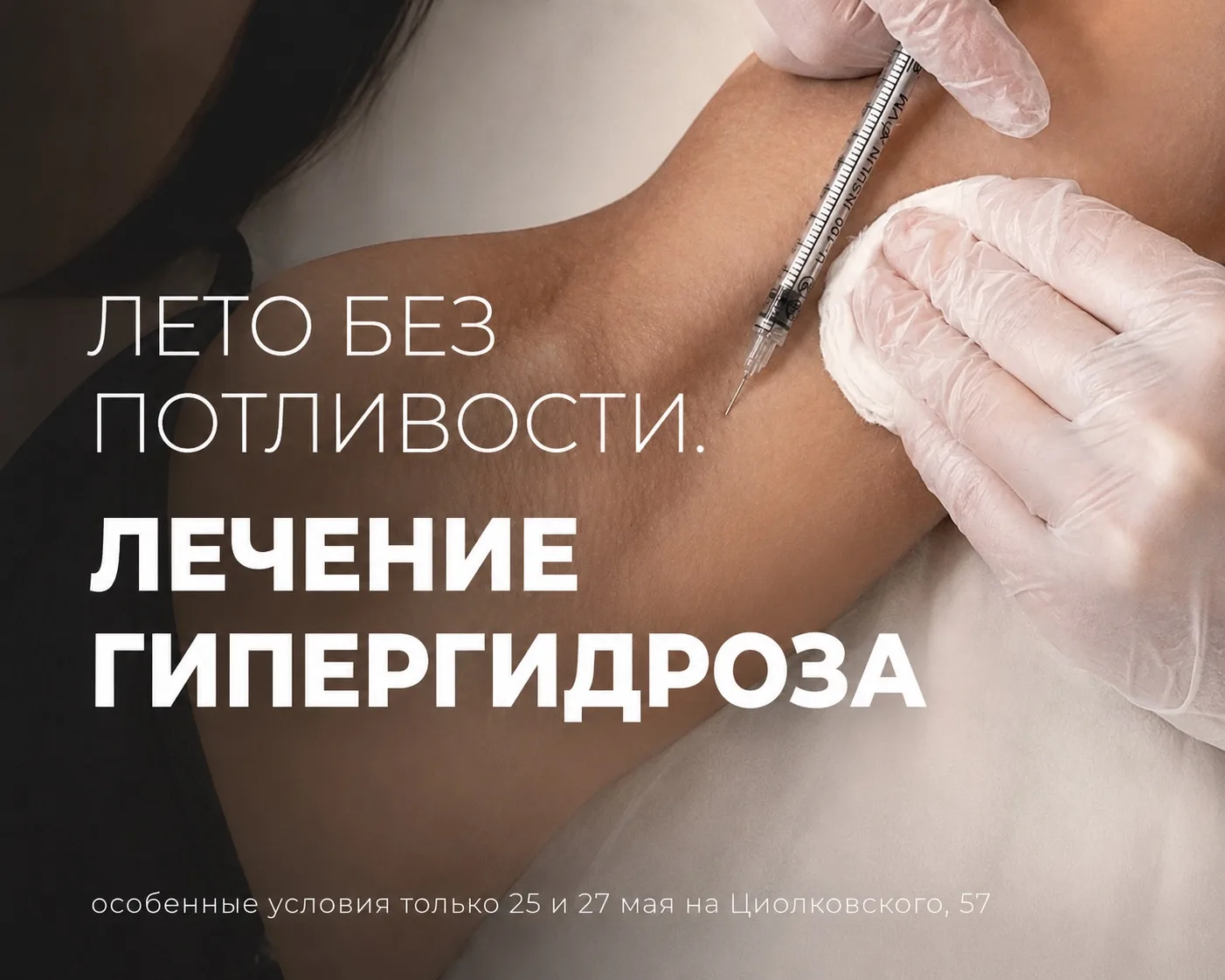 Гипергидроз: профессиональное решение к лету - выгода 4000 ₽