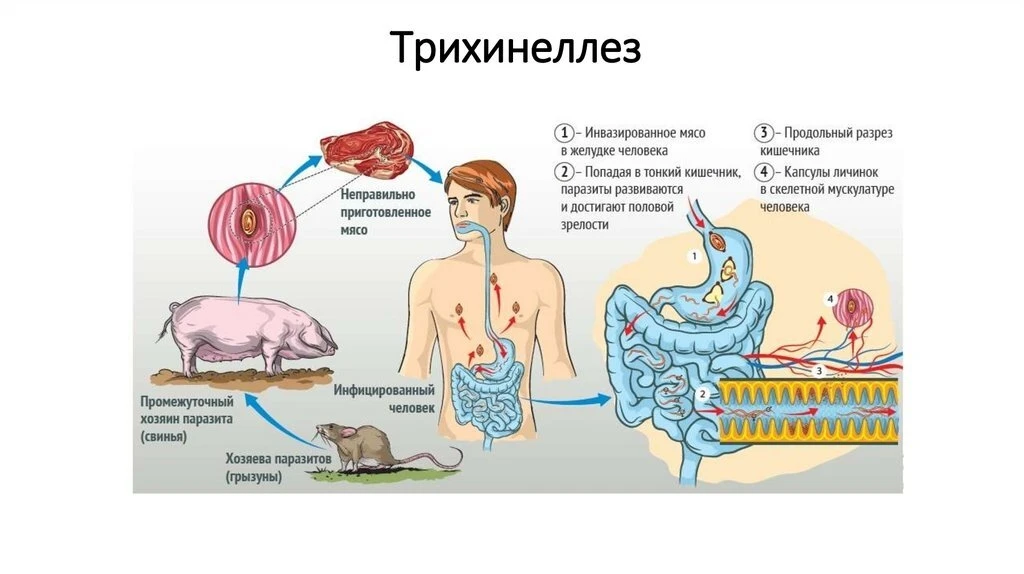 Это должен знать каждый. Трихинелла - беспощадна.