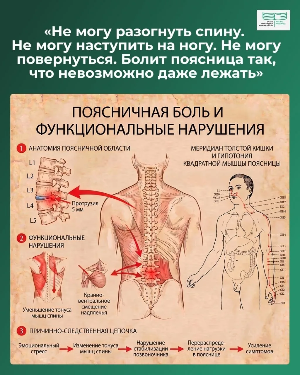 «Не могу разогнуть спину. Не могу наступить на ногу. Не могу повернуться. Болит поясниц...
