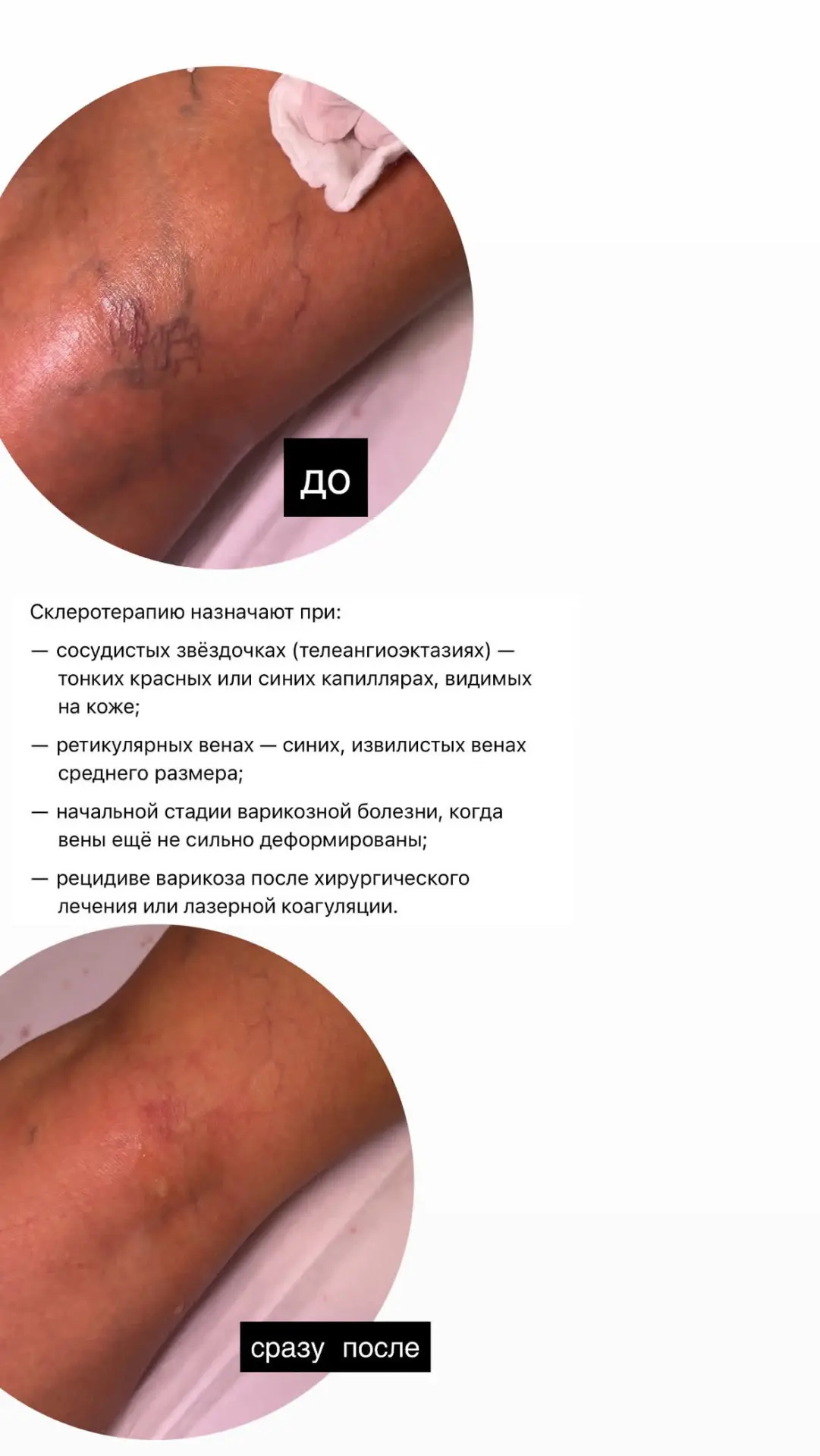 Вчера у нас в клинике состоялся долгожданный прием флеболога 🔥