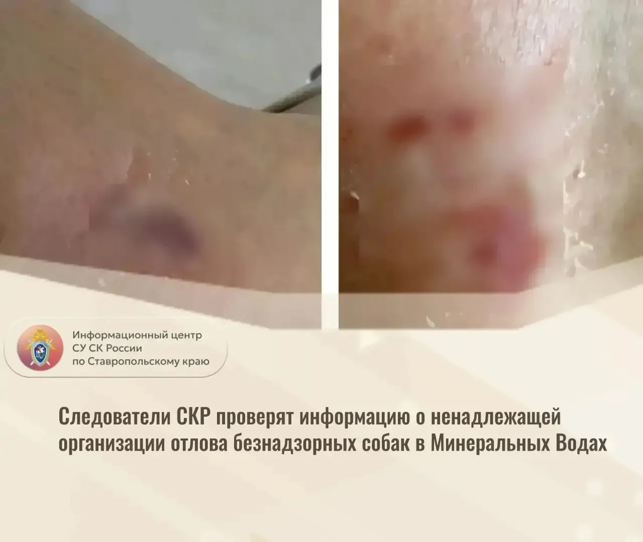 Следователи СКР проверят информацию о ненадлежащей организации отлова безнадзорных соба...