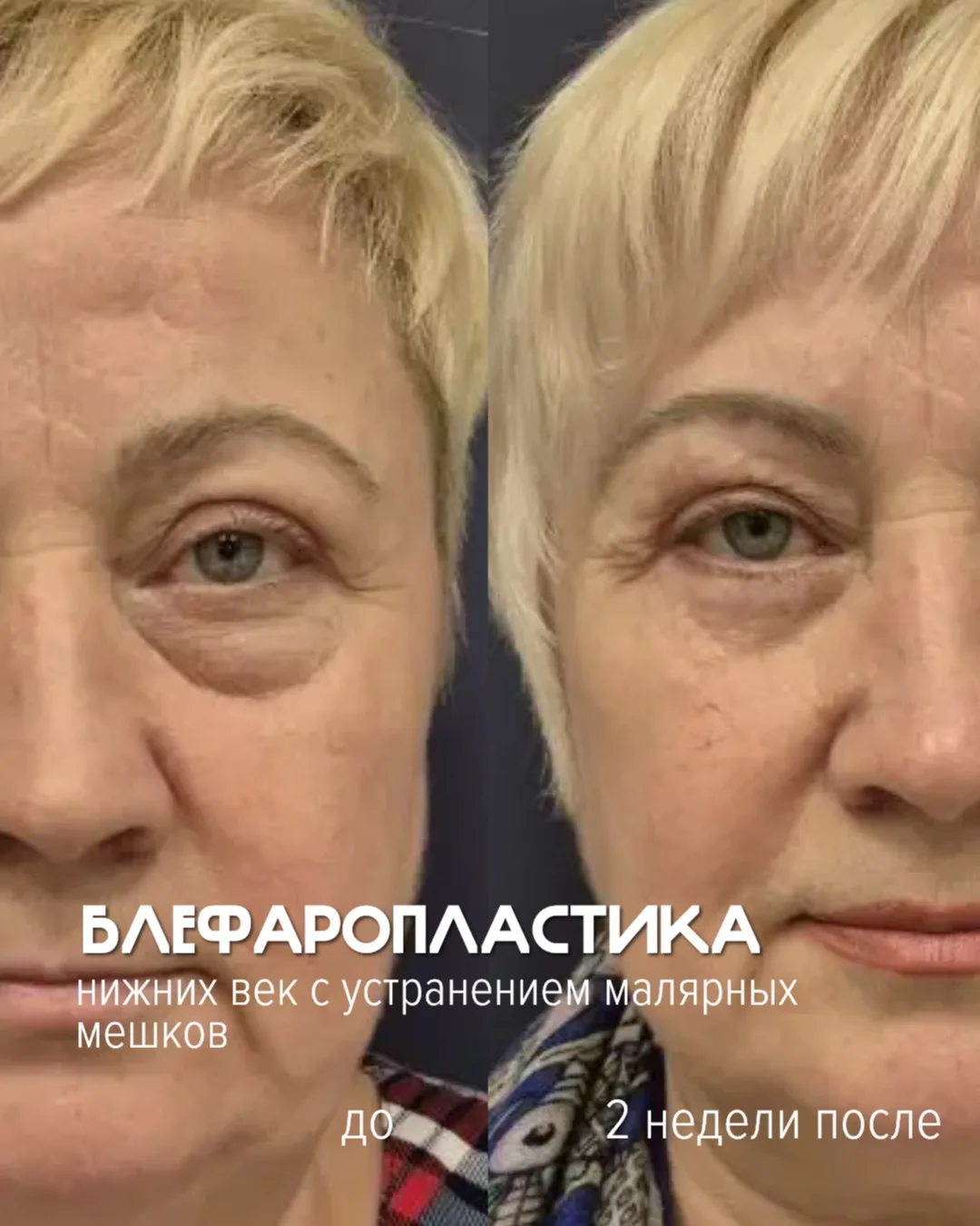 Записаться на консультацию можно по телефону: 
+7 (473) 300-36-03 
+7 (473) 300-37-03

Весь июнь кон
