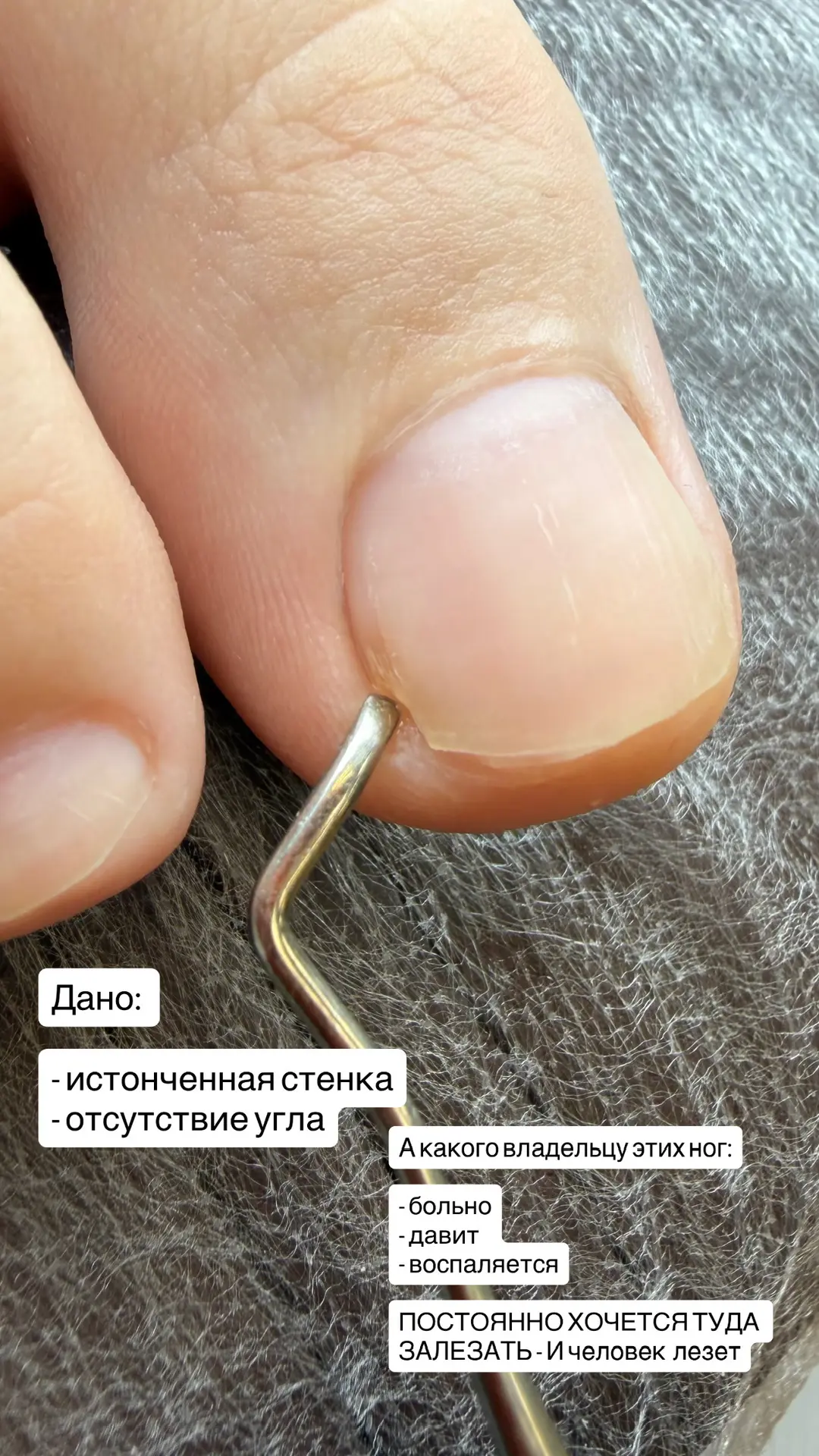 ‼️ Отсутствие боковых стенок всегда несет за собой боль. Рассказала, что нужно сделать ...