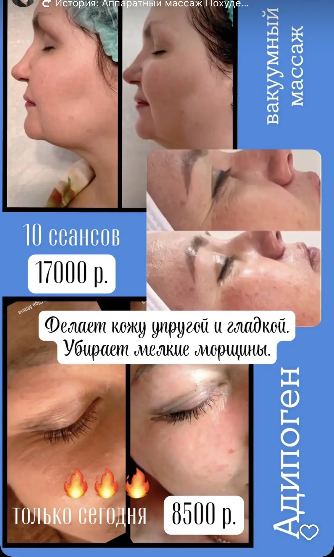 Абонементы на лицо