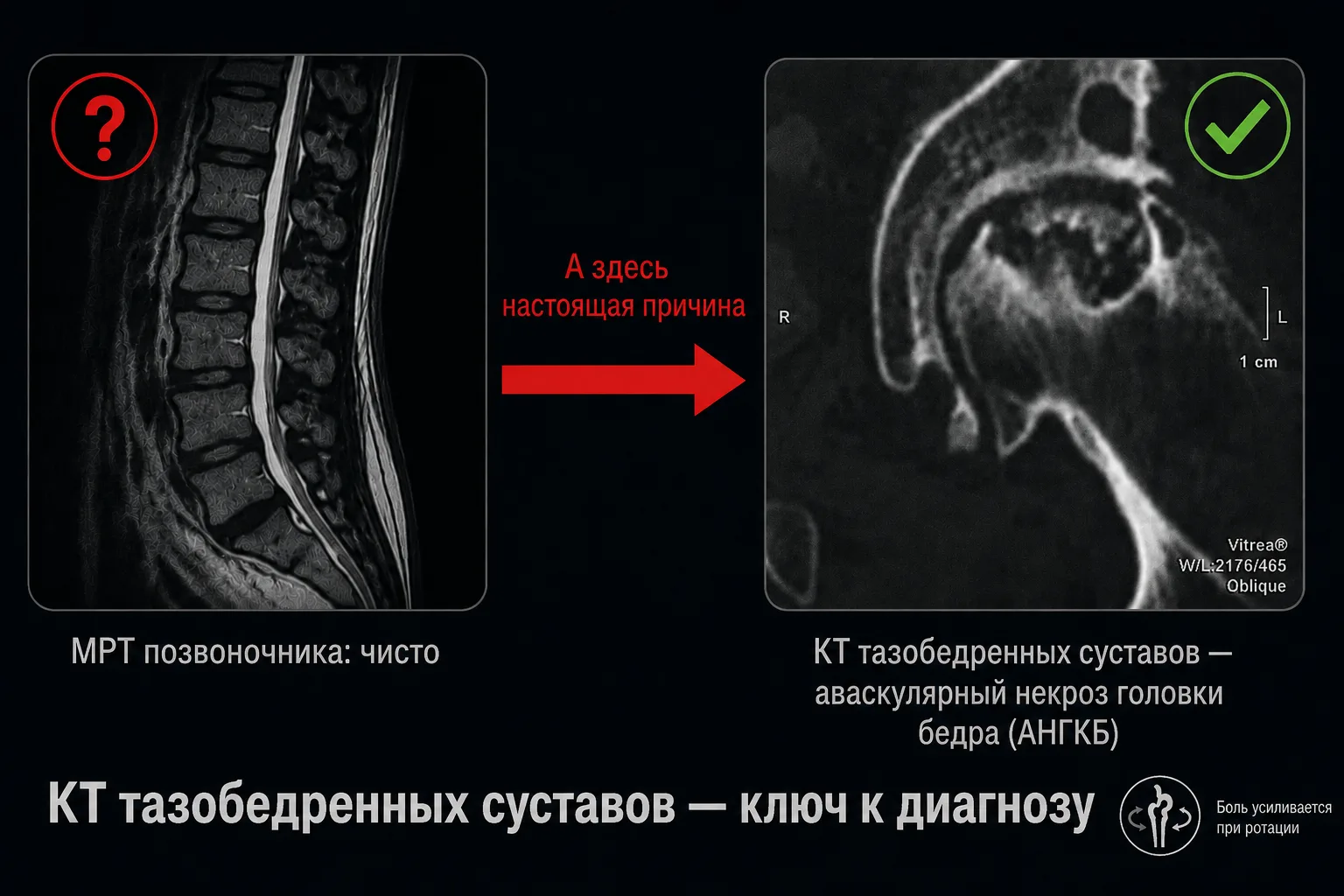 БОЛИТ ПОЯСНИЦА И БЕДРО? НЕВРОЛОГ, ПРОВЕРЬТЕ ТАЗ!

Пациент, 40 лет, жалуется на боль в пояснице и таз