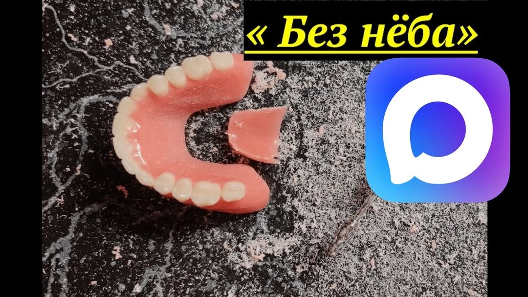 Канал N1 в MAX по СъЁмному Протезированию
