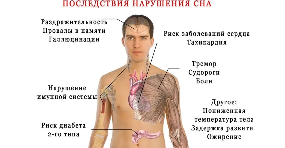“Анна, так что же делать? Мой муж ужасно храпит годами!”  Если у мужа есть лишний вес, то ему нужно 
