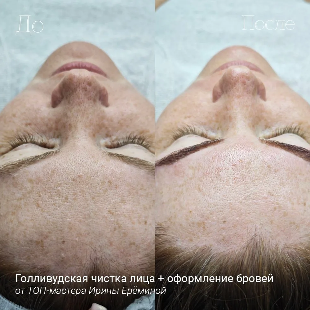 Какие услуги я оказываю в кабинете: уходы за лицом
