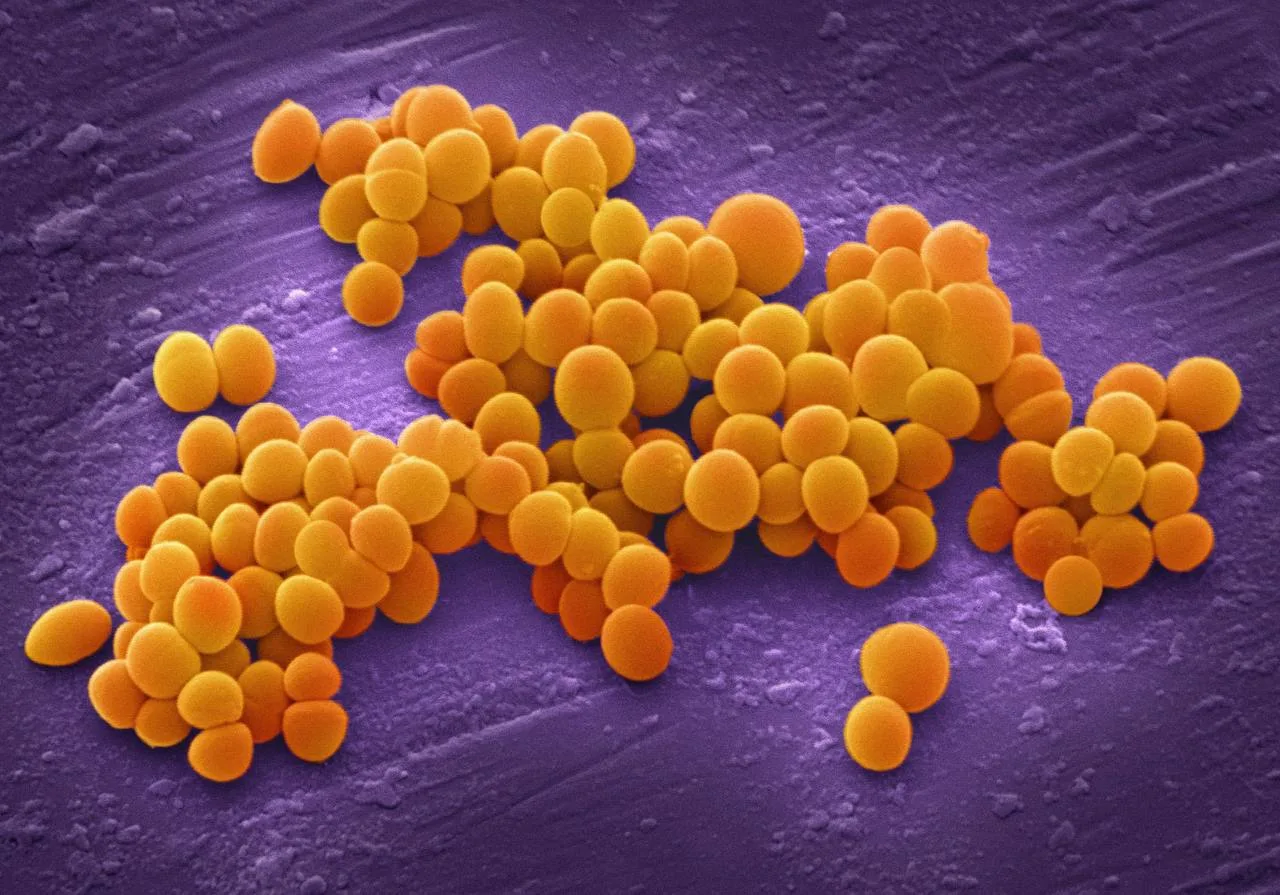 Золотистый стафилококк (Staphylococcus aureus) - это бактерия, которая является одной из главных при