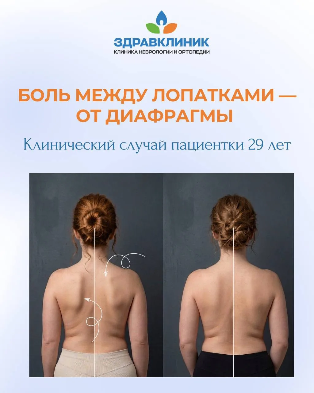 Пациентка, 29 лет, обратилась с жгучей болью между лопатками, мешавшей глубоко дышать и...